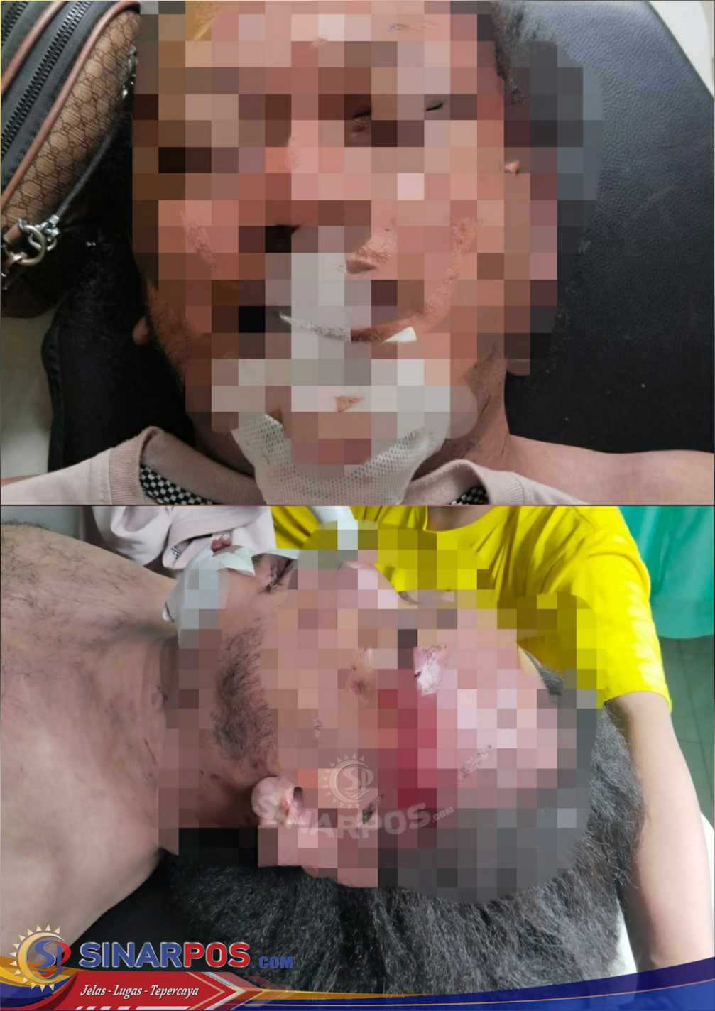 Jurnalis Media Online Tewas di Kos Jalan Pasundan Medan Baru, IPTU PM Tambunan: Masih Kita Lakukan Penyidikan Penyebab Pasti Kematian